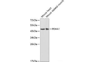 Western blot analysis of extracts of various cell lines using PDHA1 Polyclonal Antibody at dilution of 1:1000. (PDHA1 Antikörper)