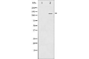 Western blot analysis of HDAC4 expression in HeLa whole cell lysates,The lane on the left is treated with the antigen-specific peptide. (HDAC4 Antikörper  (Internal Region))