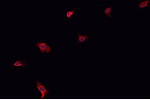 Immunofluorescence (fixed cells) (IF/ICC) image for anti-ATP-Binding Cassette, Sub-Family G (WHITE), Member 8 (ABCG8) (Internal Region) antibody (ABIN6259696)