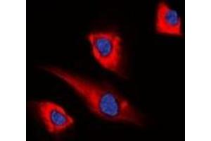Immunofluorescent analysis of PEA15 staining in HEK293T cells. (PEA15 Antikörper)