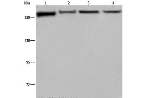 Western Blot analysis of PC3, Hela, NIH/3T3 and HUVEC cell using FLNA Polyclonal Antibody at dilution of 1:800 (Filamin A Antikörper)