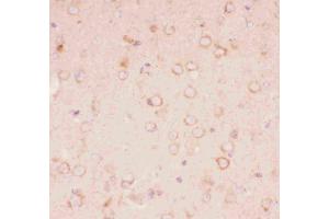 Immunohistochemistry (IHC) image for anti-Tuberous Sclerosis 2 (TSC2) (AA 1611-1807) antibody (ABIN3043498)