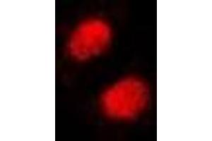 Immunofluorescent analysis of SSRP1 staining in Hela cells. (SSRP1 Antikörper)