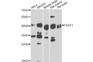Western blot analysis of extracts of various cell lines, using PSAT1 antibody (ABIN6293473) at 1:1000 dilution. (PSAT1 Antikörper)