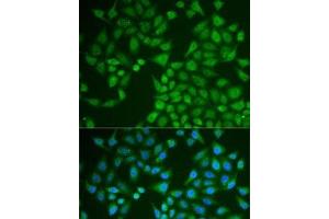 Immunofluorescence analysis of U2OS cells using PNLIP Polyclonal Antibody (PNLIP Antikörper)