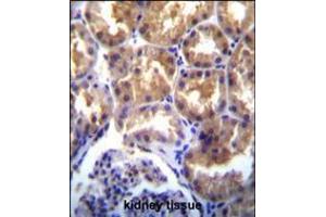 TRPM6(CHAK2) Antibody immunohistochemistry analysis in formalin fixed and paraffin embedded human kidney tissue followed by peroxidase conjugation of the secondary antibody and DAB staining. (TRPM6 Antikörper  (AA 317-348))