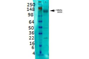 Western Blot analysis of Rat brain membrane lysate showing detection of KCC2 protein using Mouse Anti-KCC2 Monoclonal Antibody, Clone S1-12 .