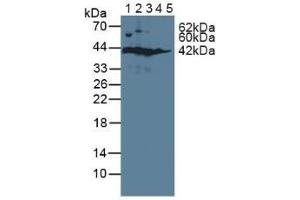 Figure. (SORD Antikörper  (AA 2-357))