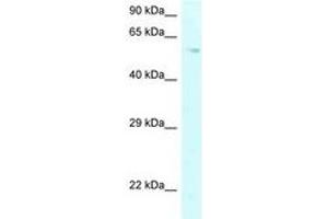 Image no. 1 for anti-Prolyl 4-Hydroxylase, alpha Polypeptide II (P4HA2) (AA 289-338) antibody (ABIN6747697) (P4HA2 Antikörper  (AA 289-338))
