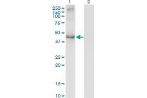 Western Blot analysis of TCN2 expression in transfected 293T cell line by TCN2 monoclonal antibody (M01), clone 2F4. (TCN2 Antikörper  (AA 1-400))
