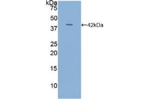 Detection of Recombinant NT-ProANP, Human using Polyclonal Antibody to N-Terminal Pro-Atrial Natriuretic Peptide (NT-ProANP) (PRO-ANP Antikörper  (AA 25-123))