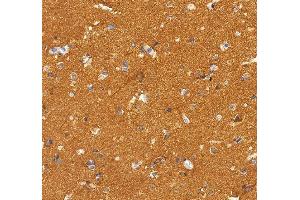 IHC analysis of NSF using anti-NSF antibody (ABIN7601630). (NSF Antikörper  (AA 4-636))