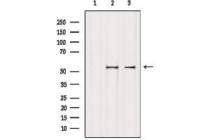 Western Blotting (WB) image for anti-Keratin 8 (KRT8) (C-Term) antibody (ABIN6262789)