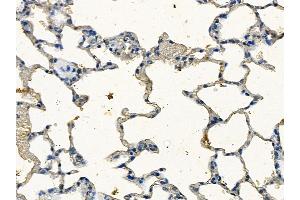 ABIN7094272 and ABIN7098319 at 1/100 staining rat lung tissue by IHC-P.