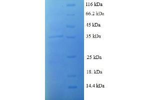 SDS-PAGE (SDS) image for Chemokine (C-C Motif) Ligand 8 (CCL8) (AA 24-99) protein (His tag) (ABIN5709221)