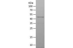 slc25a13 Protein (AA 251-500) (His-IF2DI Tag)