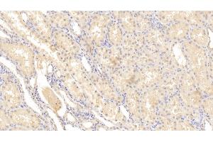 Detection of MMP2 in Human Kidney Tissue using Monoclonal Antibody to Matrix Metalloproteinase 2 (MMP2)