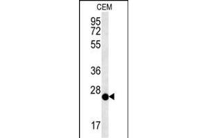 CRISPLD2 Antibody (N-term) (ABIN651759 and ABIN2840390) western blot analysis in CEM cell line lysates (15 μg/lane). (CRISPLD2 Antikörper  (N-Term))