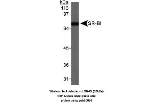 Image no. 1 for anti-Scavenger Receptor Class B, Member 1 (SCARB1) antibody (ABIN363335) (SCARB1 Antikörper)