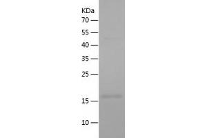 Caspase 8 Protein (CASP8) (AA 217-374) (His tag)