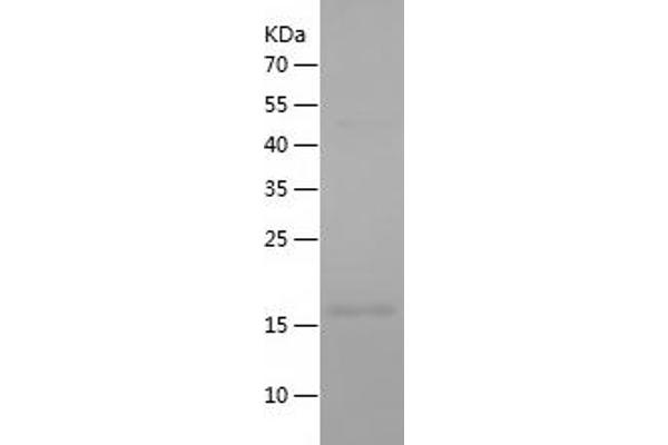 Caspase 8 Protein (CASP8) (AA 217-374) (His tag)