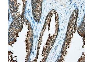 Immunohistochemical staining of paraffin-embedded prostate tissue using anti-DNTTIP1 mouse monoclonal antibody. (DNTTIP1 Antikörper)
