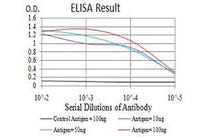 Black line: Control Antigen (100 ng),Purple line: Antigen (10 ng), Blue line: Antigen (50 ng), Red line:Antigen (100 ng) (ADAMTS1 Antikörper  (AA 858-960))