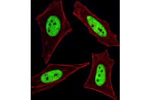 Fluorescent image of HeLa cells stained with Cellular Apoptosis Susceptibility Antibody (N-term) (ABIN1882070 and ABIN2838356). (CSE1L Antikörper  (N-Term))