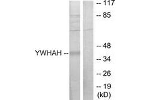 Western blot analysis of extracts from Jurkat cells, using 14-3-3 eta Antibody. (14-3-3 eta Antikörper  (AA 51-100))
