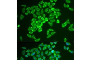 Immunofluorescence analysis of A549 cells using KEAP1 Polyclonal Antibody (KEAP1 Antikörper)