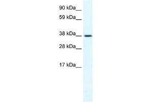 WB Suggested Anti-TRPM3 Antibody Titration:  1. (TRPM3 Antikörper  (N-Term))