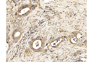 IHC analysis of MLX-interacting protein/MLXIP using anti-MLX-interacting protein/MLXIP antibody (ABIN7602593). (MLXIP Antikörper  (AA 88-348))