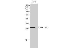 Western Blotting (WB) image for anti-C/EBP delta/epsilon (C-Term) antibody (ABIN3174089) (C/EBP delta/epsilon (C-Term) Antikörper)