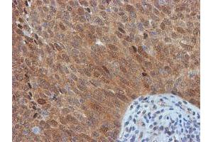 Image no. 14 for anti-F-Box Protein 21 (FBXO21) antibody (ABIN1498235)