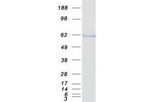 Western Blotting (WB) image for Telomeric Repeat Binding Factor 2 (TERF2) protein (Myc-DYKDDDDK Tag) (ABIN2733429)