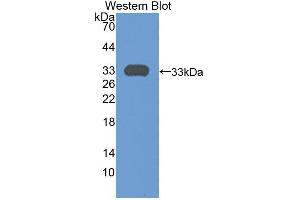 Western blot analysis of the recombinant protein. (Plexin A1 Antikörper  (AA 43-300))