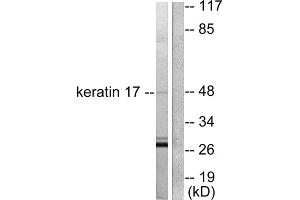 Western blot analysis of extracts from HuvEc cells, using keratin 17 antibody (ABIN5976437). (KRT17 Antikörper  (C-Term))