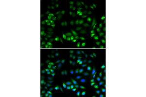 Immunofluorescence analysis of U2OS cells using MANF antibody (ABIN5974212). (MANF Antikörper)
