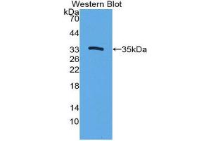 Western Blotting (WB) image for anti-Cytochrome P450, Family 7, Subfamily A, Polypeptide 1 (CYP7A1) (AA 109-383) antibody (ABIN1862411)