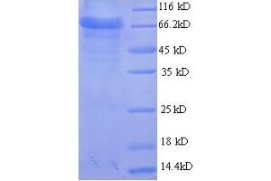 SDS-PAGE (SDS) image for Acetylcholinesterase (AChE) (AA 31-613) protein (GST tag) (ABIN5708991)