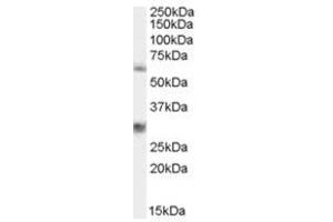 Image no. 1 for anti-Membrane Protein, Palmitoylated 6 (MAGUK P55 Subfamily Member 6) (MPP6) (N-Term) antibody (ABIN374387) (MPP6 Antikörper  (N-Term))