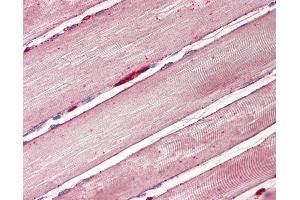 Anti-GLUT4 antibody IHC of human skeletal muscle. (GLUT4 Antikörper  (AA 498-509))