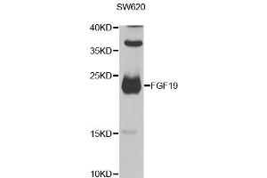 Western blot analysis of extracts of SW620 cells, using FGF19 antibody (ABIN2562584) at 1:1000 dilution. (FGF19 Antikörper)