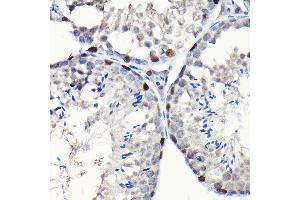 Immunohistochemistry (IHC) image for anti-GTP Binding Protein 4 (GTPBP4) (AA 385-634) antibody (ABIN1680142)