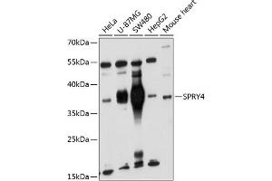Western blot analysis of extracts of various cell lines, using SPRY4 antibody (ABIN6132548, ABIN6148395, ABIN6148396 and ABIN6221865) at 1:1000 dilution. (SPRY4 Antikörper  (AA 30-210))