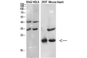 Western Blot (WB) analysis of specific cells using Antibody diluted at 1:1000. (CCL27 Antikörper)