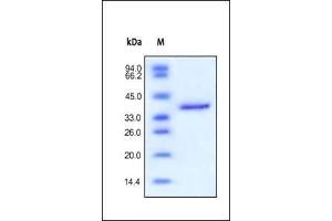 Human IGF-II, Fc Tag on SDS-PAGE under reducing (R) condition. (IGF2 Protein (AA 25-91) (Fc Tag))