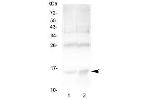 Western blot testing of 1) rat spleen and 2) human U-2 OS cell lysate with Hemoglobin antibody at 0. (HBA1 Antikörper)