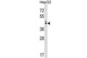 Western Blotting (WB) image for anti-Neuroguidin, EIF4E Binding Protein (NGDN) antibody (ABIN2998327) (NGDN Antikörper)