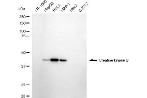 Western blotting analysis using creatine kinase B antibody (ABIN7798162). (Rekombinanter CKB Antikörper)